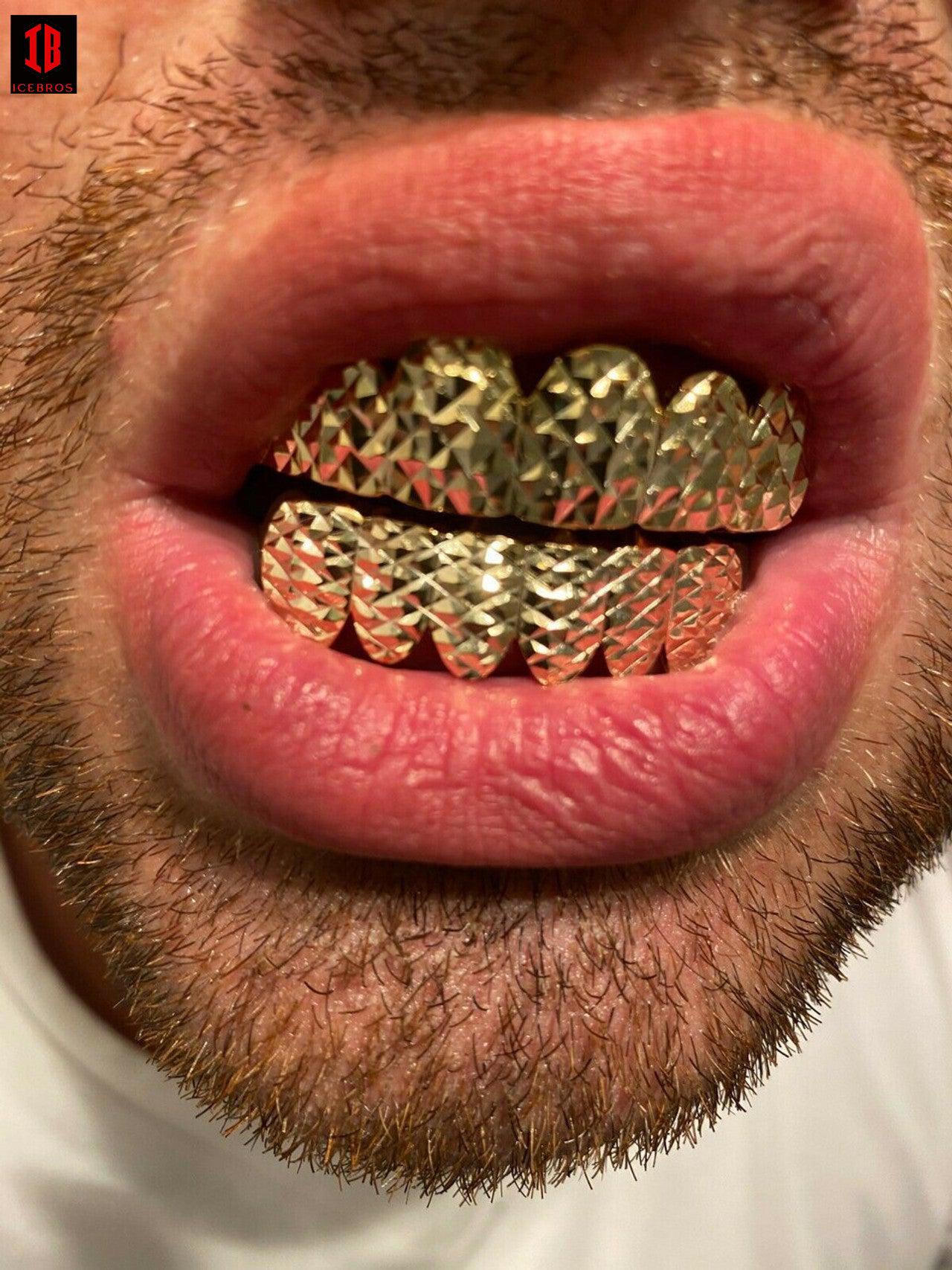 14k Gold Over Solid 925 Sterling Silver Diamond Cut Grillz Teeth Fronts